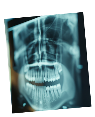 Dabrident Bacău - Stomatologie și Radiologie Dentară